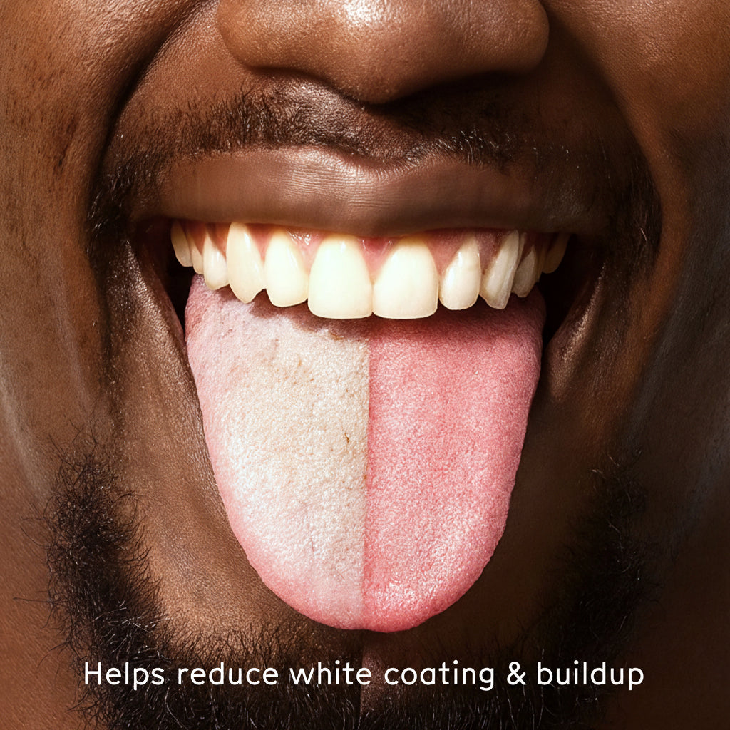 Close-up of a tongue with white coating to illustrate the benefits of a tongue scraper