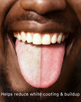 Close-up of a tongue with white coating to illustrate the benefits of a tongue scraper